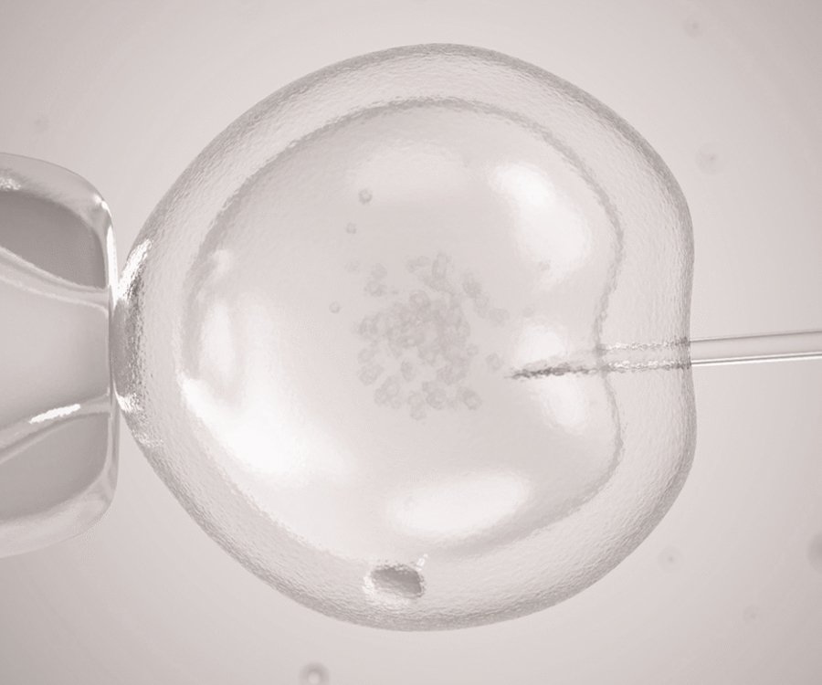 Fertilização in Vitro