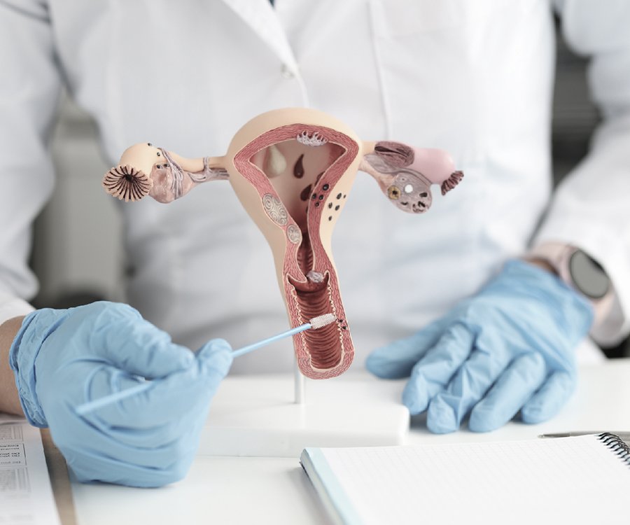 Infecções Ginecológicas